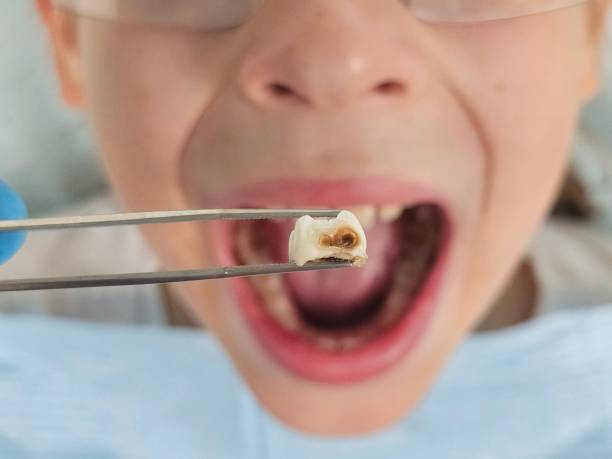 Best Emergency Tooth Extraction in , NJ